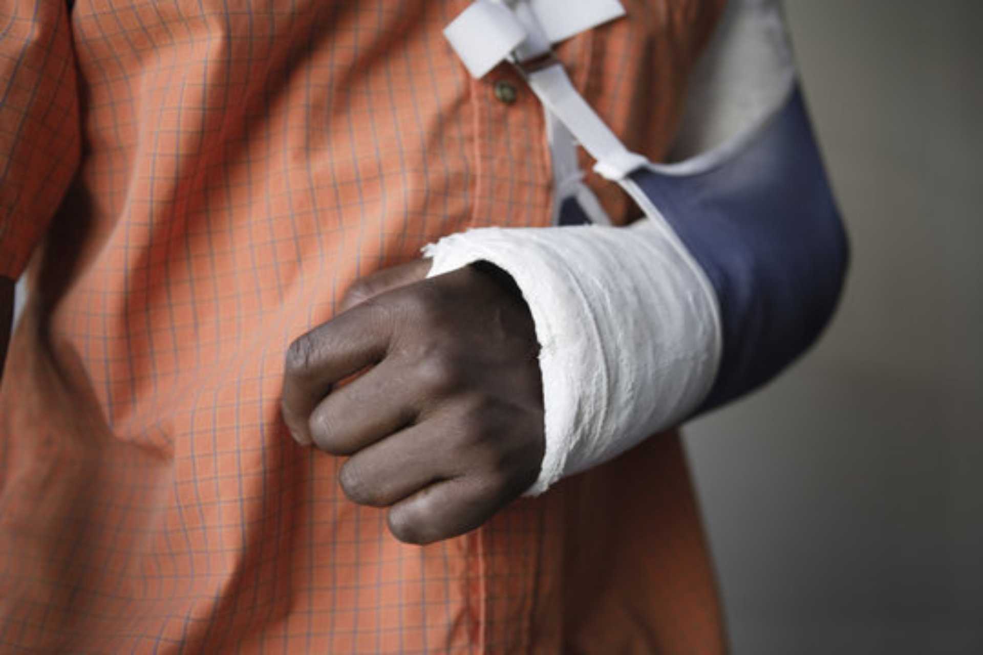 What Is The Average Settlement For Broken Arm In Car Accident 